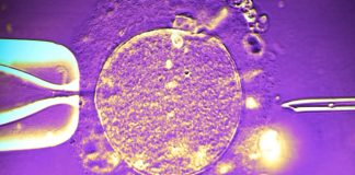 Δότης σπέρματος με σπάνιο γονίδιο καρκίνου, έγινε πατέρας σχεδόν 200 παιδιών! Και στην Ελλάδα