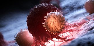 Ο αποκλεισμός μιας πρωτεΐνης επιβραδύνει την ανάπτυξη του καρκίνου, ανακαλύπτουν οι επιστήμονες