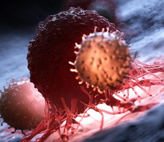 Ο καρκίνος του εγκεφάλου ξεκινά πολύ πριν τον ιατρικό εντοπισμό!