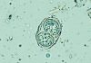 Toxoplasma gondii