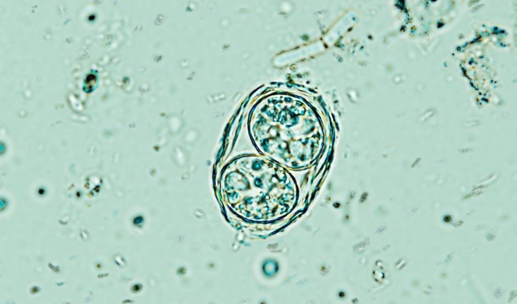 Toxoplasma gondii Toxoplasma gondii