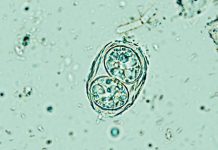 Toxoplasma gondii