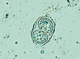 Toxoplasma gondii