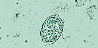 Toxoplasma gondii
