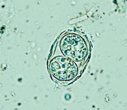 Toxoplasma gondii: Ανατροπή με το παράσιτο του εγκεφάλου, σημάδια δραστηριοποίησης! Toxoplasma gondii