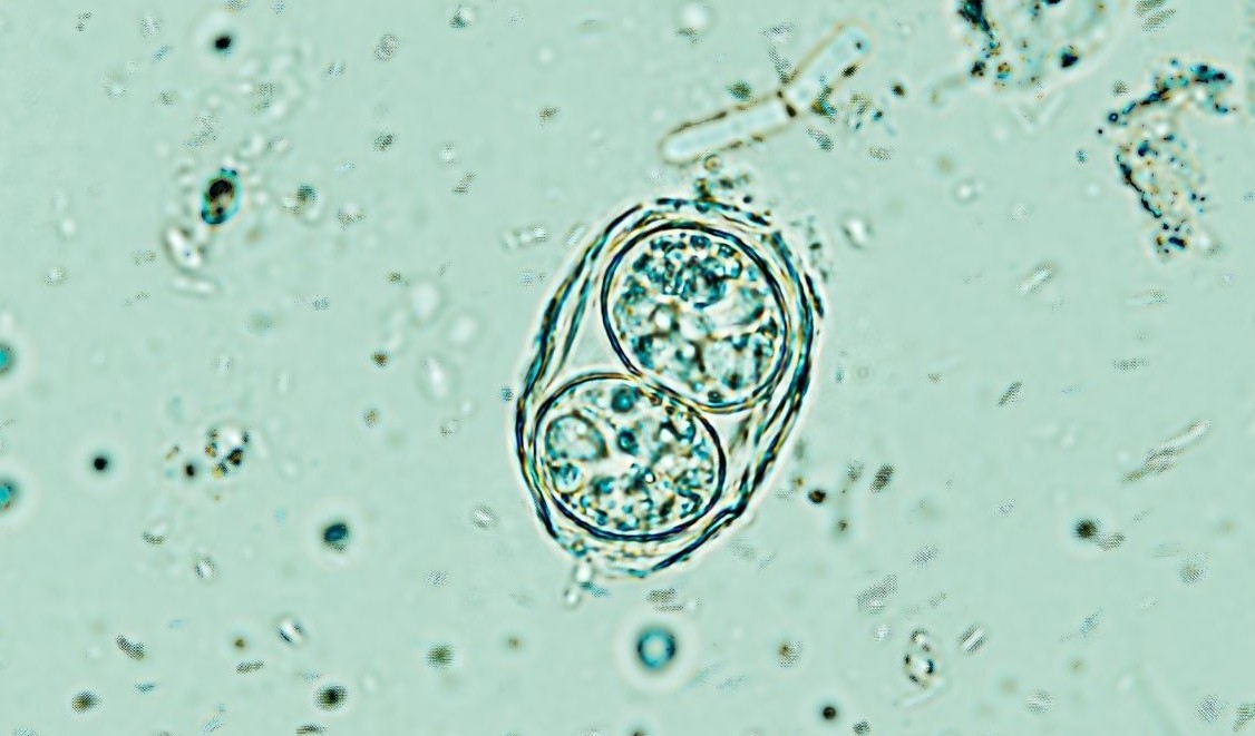 Toxoplasma gondii