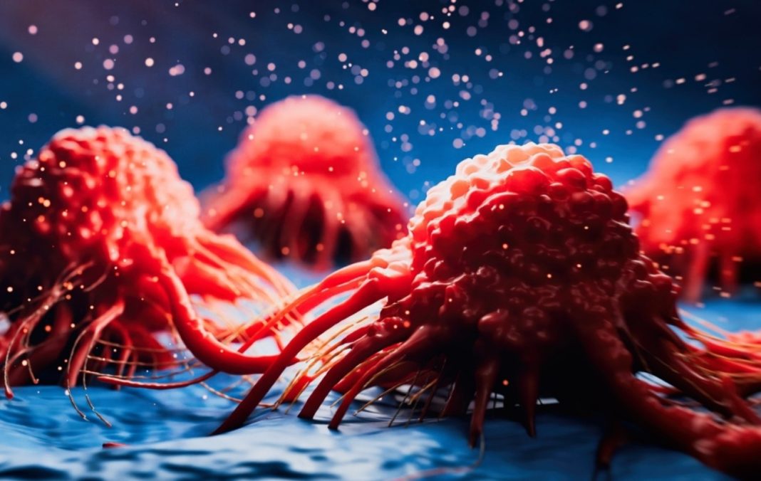 cancer καρκίνος του παγκρέατος