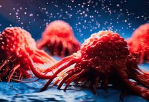 καρκίνος του παγκρέατος