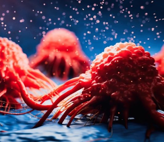 Νίκησαν για πρώτη φορά το πιο επιθετικό είδος καρκίνου στο εργαστήριο! καρκίνος του παγκρέατος