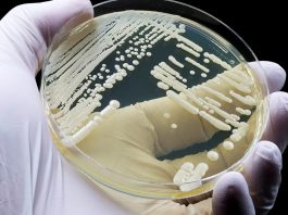 Candida auris: Ο θανατηφόρος μύκητας που εξαπλώνεται ραγδαία! Είστε μόνοι!