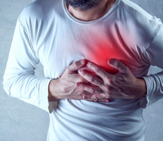 To 99% των καρδιακών προσβολών και εγκεφαλικών συνδέονται με 4 παράγοντες κινδύνου καρδιακών προσβολών