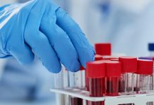 καρκίνος διάγνωση