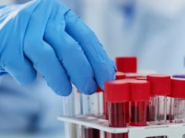 καρκίνος διάγνωση