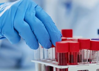 καρκίνος διάγνωση