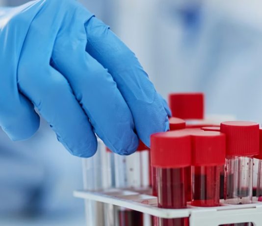 καρκίνος διάγνωση