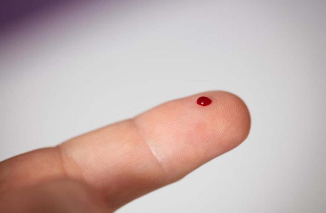 εξέταση αίματος καρκίνο