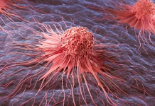 Το μόριο κλειδί που πυροδοτεί καρκίνο του δέρματος και ξεγελά το ανοσοποιητικό Μελάνωμα έρευνα HOXD13 κύτταρα