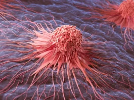 Το μόριο κλειδί που πυροδοτεί καρκίνο του δέρματος και ξεγελά το ανοσοποιητικό Μελάνωμα έρευνα HOXD13 κύτταρα