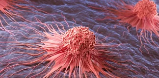 Το μόριο κλειδί που πυροδοτεί καρκίνο του δέρματος και ξεγελά το ανοσοποιητικό Μελάνωμα έρευνα HOXD13 κύτταρα