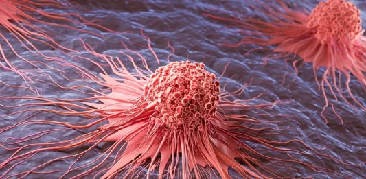 Μελάνωμα έρευνα HOXD13 κύτταρα