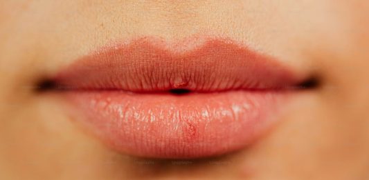 Ο τρόπος που μιλάμε ίσως το πρώτο πρώιμο προειδοποιητικό σημάδι τρόπος που μιλάμε