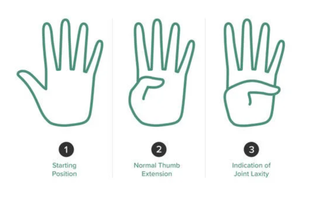thumb test