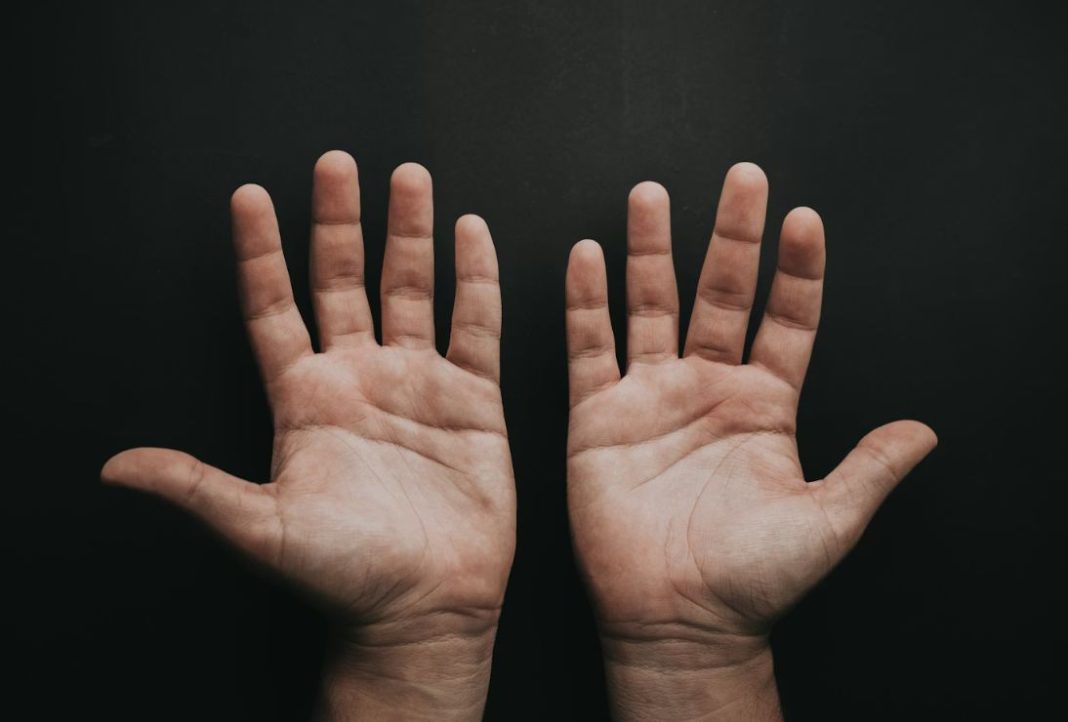 ακρομεγαλία ασθένεια