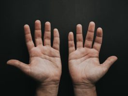 ακρομεγαλία ασθένεια