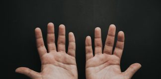 ακρομεγαλία ασθένεια