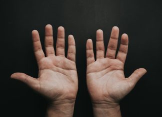 ακρομεγαλία ασθένεια