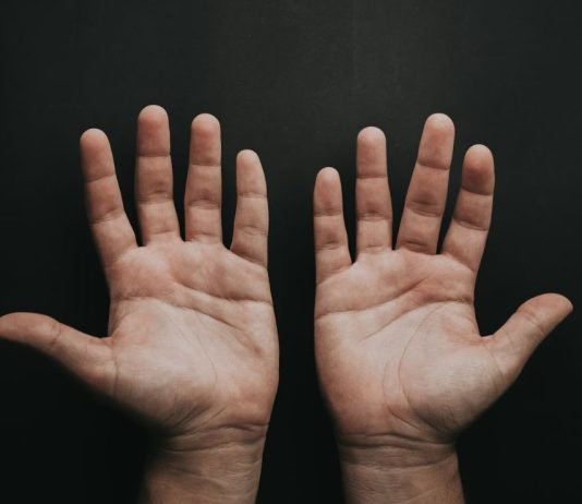 ακρομεγαλία ασθένεια