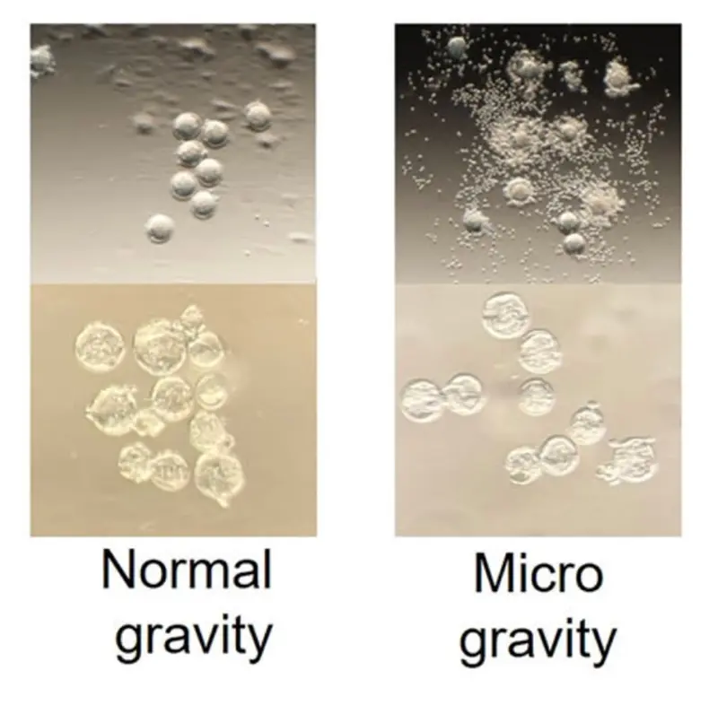 σπέρμα σπερματοζωάρια