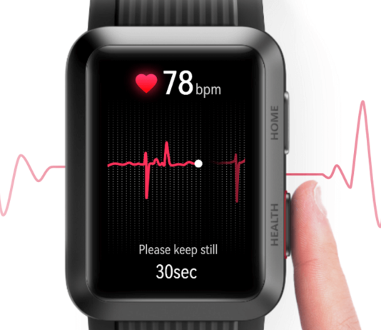smartwatch