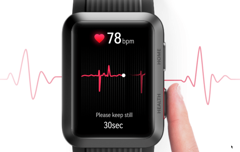 smartwatch