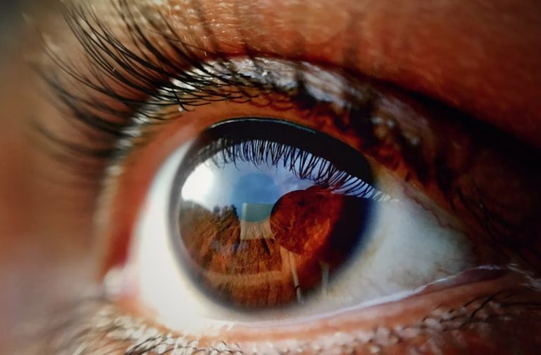 eye
