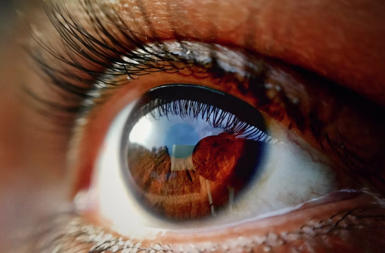 eye