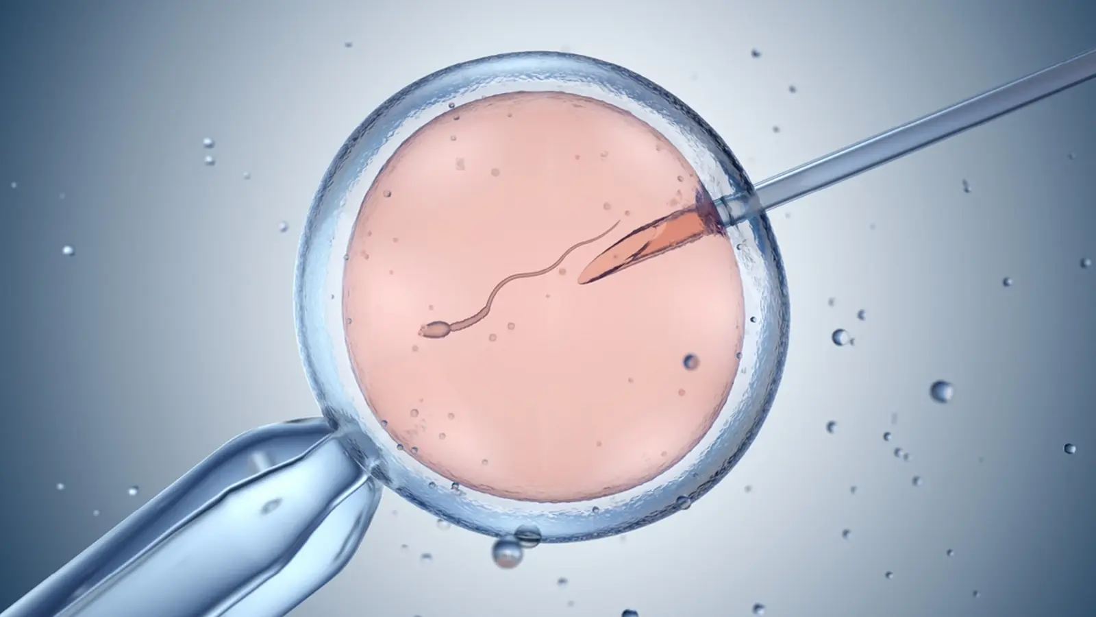 IVF γωνιμοποίηση ωαρίου
